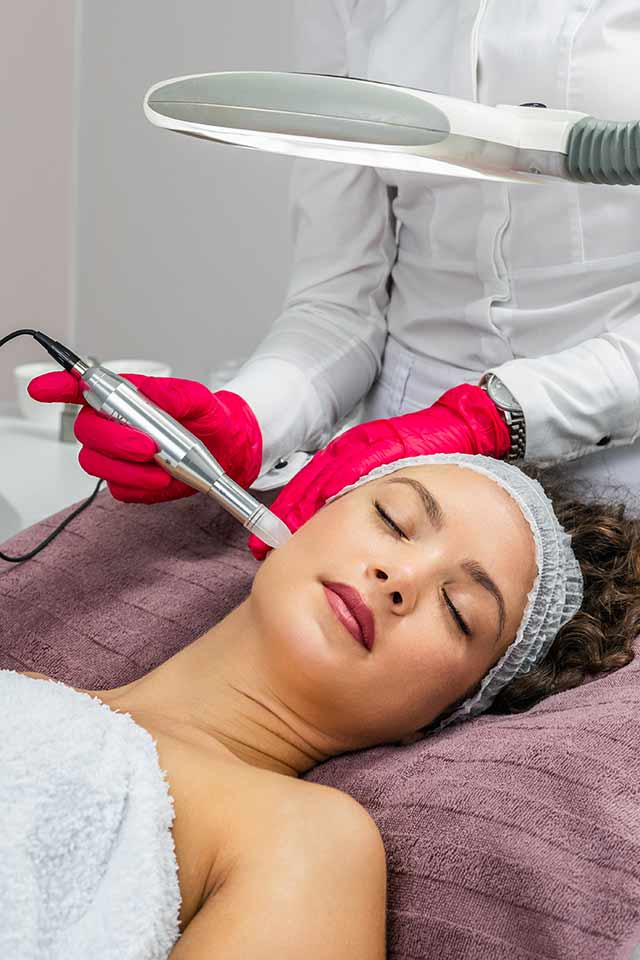 Microneedling